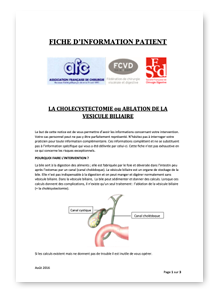 fiche cholecystectomie